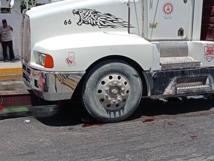 volquete-arrolla-ciclista-en-playa-del-carmen-y-le-destroza-la-pierna-2