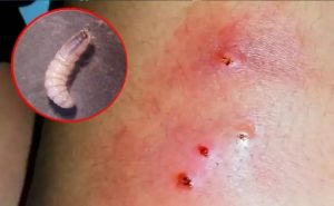 Las larvas se alimentan de tejido vivo