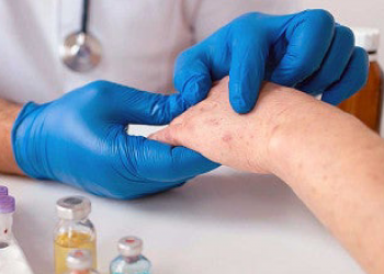 Se dispara el sarampión: 197 casos nuevos en 4 días