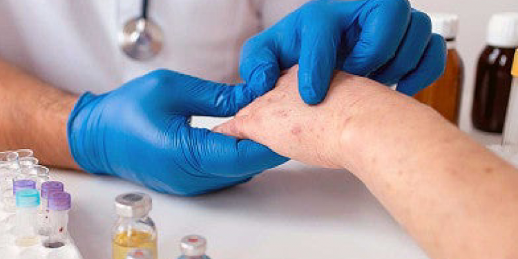 Se dispara el sarampión: 197 casos nuevos en 4 días