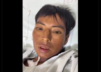 Hospitalizado en Chetumal