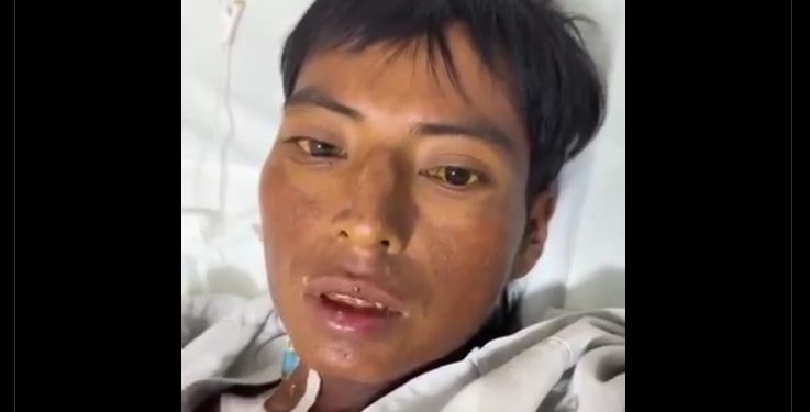 Hospitalizado en Chetumal