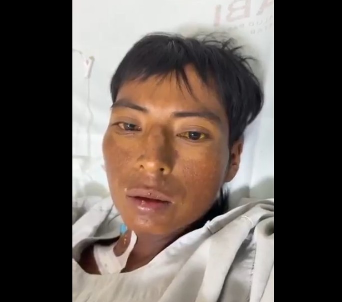 Hospitalizado en Chetumal: diagnóstico delicado 