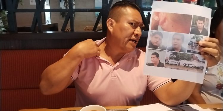 Vecino de Tulum denuncia agresión por presuntos escoltas del presidente municipal Diego Castañón