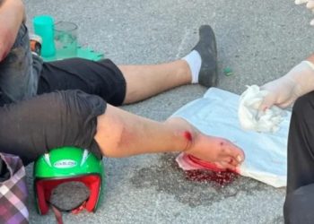 Mujer sufre fractura en Tulum tras ser atacada por perros en fraccionamiento Las Palmas