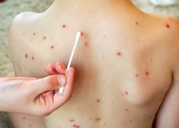 Tabasco descarta filtros sanitarios en escuelas ante casos de sarampión