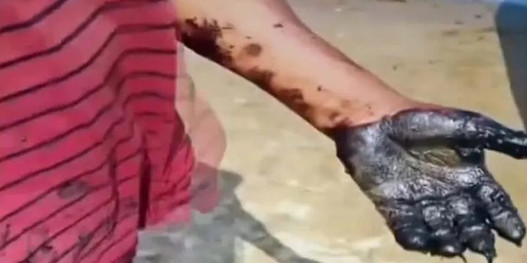 Denuncian presencia de chapopote en 16 puntos costeros de Veracruz y Tabasco; alertan daños a pesca y fauna